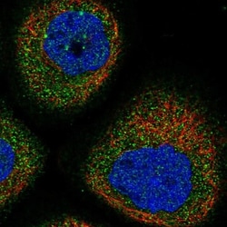DPH4 Antibody, Novus Biologicals 0.1mL; Unlabeled:Antibodies, Polyclonal
